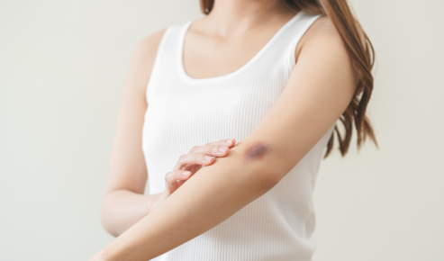 Arnigel® bleu bras femme