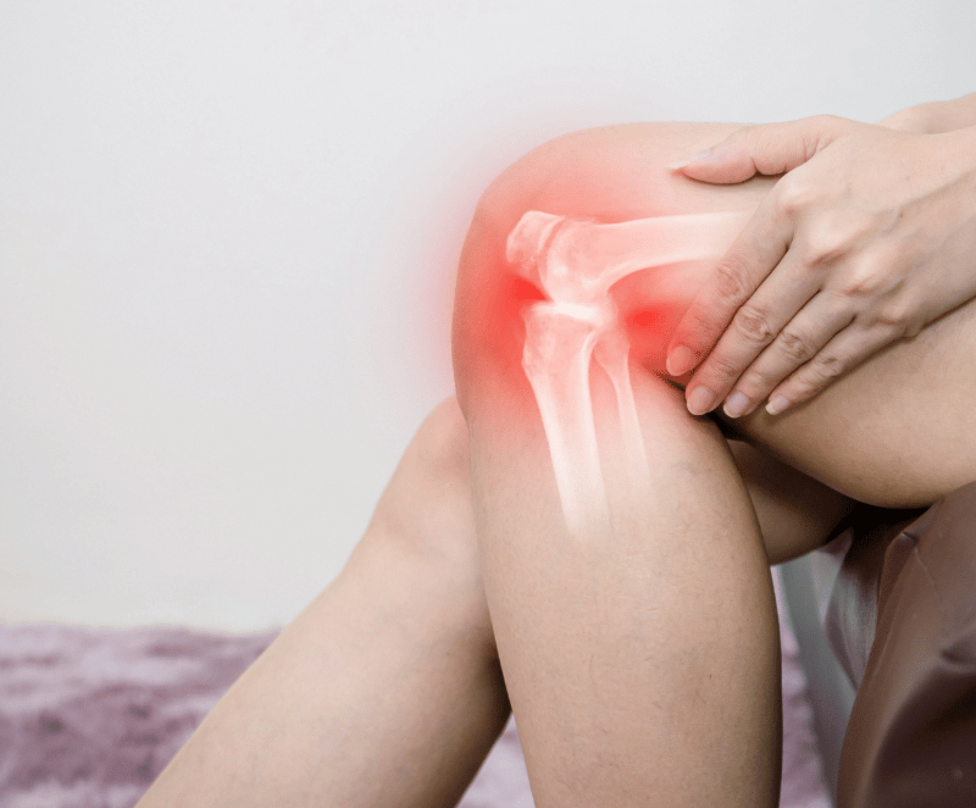 Arthrose genoux
